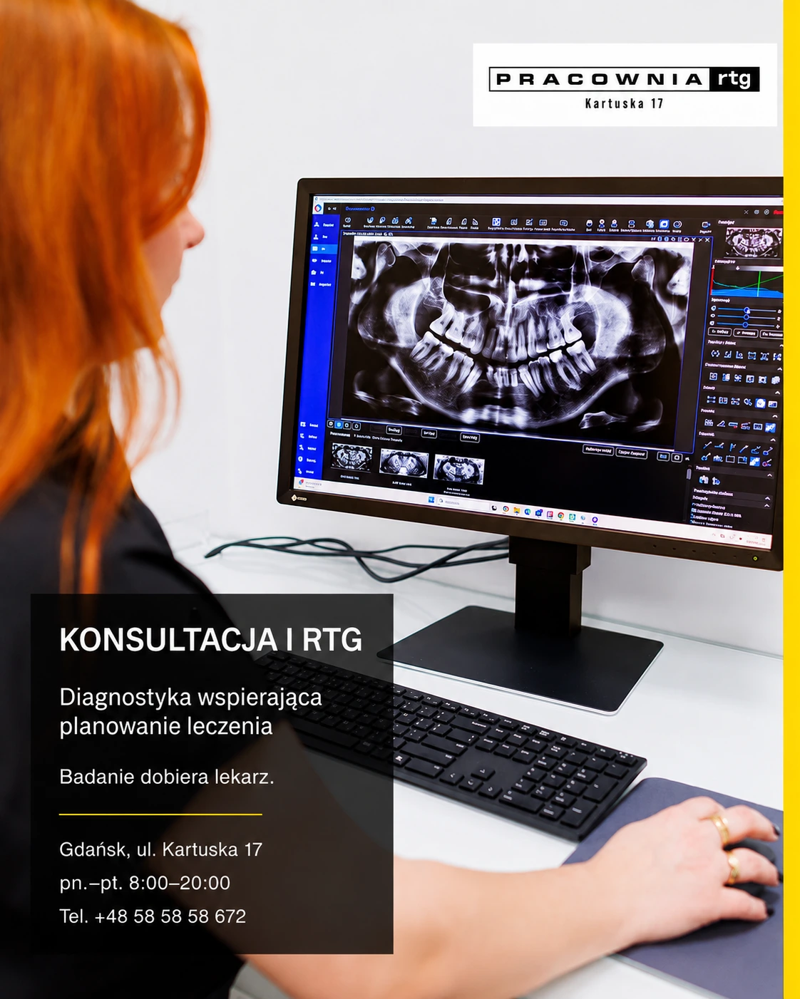 RTG Gdańsk — konsultacja i diagnostyka RTG